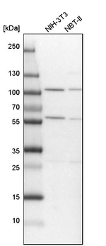 ADHFE1 Antibody in Western Blot (WB)