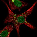 ZNF526 Polyclonal Antibody