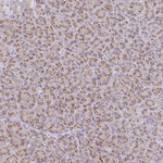 ZNF526 Antibody in Immunohistochemistry (Paraffin) (IHC (P))