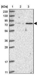 ZNF526 Antibody in Western Blot (WB)