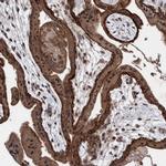 PIK3R6 Polyclonal Antibody