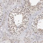 KIF2B Polyclonal Antibody