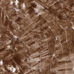 MLXIP Polyclonal Antibody