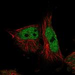 GLRX2 Polyclonal Antibody