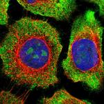 ZNF800 Polyclonal Antibody