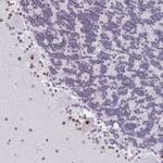 ZNF800 Antibody in Immunohistochemistry (Paraffin) (IHC (P))