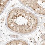 KIF2B Antibody in Immunohistochemistry (Paraffin) (IHC (P))