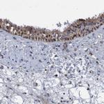 ZNF677 Antibody in Immunohistochemistry (IHC)
