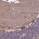 ZNF618 Antibody in Immunohistochemistry (Paraffin) (IHC (P))