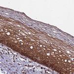 ZNF618 Antibody in Immunohistochemistry (Paraffin) (IHC (P))