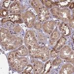 ZNF618 Antibody in Immunohistochemistry (Paraffin) (IHC (P))