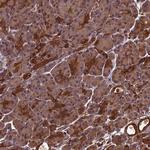 ZNF618 Polyclonal Antibody