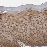 eIF3h Antibody in Immunohistochemistry (Paraffin) (IHC (P))