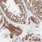 eIF3h Antibody in Immunohistochemistry (Paraffin) (IHC (P))