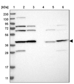 eIF3h Antibody in Western Blot (WB)