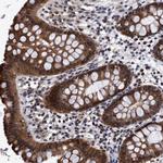 PSMD12 Antibody in Immunohistochemistry (Paraffin) (IHC (P))
