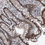 HEATR9 Antibody in Immunohistochemistry (Paraffin) (IHC (P))