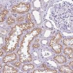 GLI4 Antibody in Immunohistochemistry (Paraffin) (IHC (P))