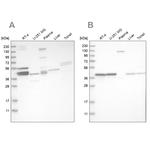 MRPL38 Antibody in Western Blot (WB)
