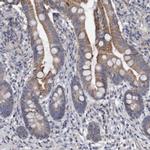 DDHD2 Polyclonal Antibody