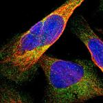 DDHD2 Polyclonal Antibody