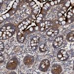 DDHD2 Antibody in Immunohistochemistry (Paraffin) (IHC (P))