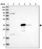 DDHD2 Antibody in Western Blot (WB)