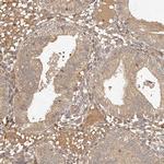 FAN Antibody in Immunohistochemistry (Paraffin) (IHC (P))