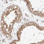 FAN Antibody in Immunohistochemistry (Paraffin) (IHC (P))