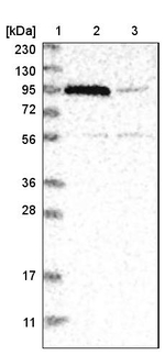 FAN Antibody in Western Blot (WB)
