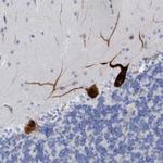 MTFR1 Antibody in Immunohistochemistry (Paraffin) (IHC (P))