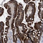 MTFR1 Antibody in Immunohistochemistry (Paraffin) (IHC (P))