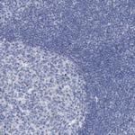 MTFR1 Antibody in Immunohistochemistry (Paraffin) (IHC (P))