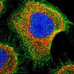 SLC45A4 Polyclonal Antibody