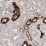 SLC45A4 Antibody in Immunohistochemistry (Paraffin) (IHC (P))