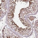 ZNF624 Antibody in Immunohistochemistry (Paraffin) (IHC (P))