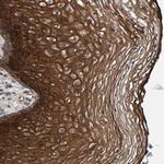 MFSD6L Polyclonal Antibody