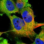 WWP1 Polyclonal Antibody