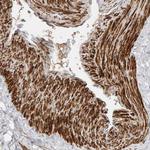 CML66 Antibody in Immunohistochemistry (Paraffin) (IHC (P))