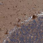 NISCH Antibody in Immunohistochemistry (Paraffin) (IHC (P))