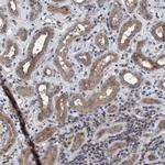 NISCH Antibody in Immunohistochemistry (Paraffin) (IHC (P))