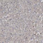NISCH Antibody in Immunohistochemistry (Paraffin) (IHC (P))