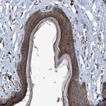 NISCH Antibody in Immunohistochemistry (Paraffin) (IHC (P))