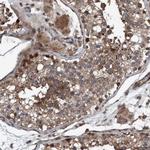 NISCH Polyclonal Antibody