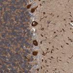 FMNL3 Polyclonal Antibody