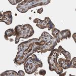 GRPEL2 Antibody in Immunohistochemistry (Paraffin) (IHC (P))