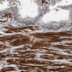 GRPEL2 Antibody in Immunohistochemistry (Paraffin) (IHC (P))