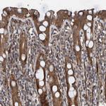 GRPEL2 Antibody in Immunohistochemistry (Paraffin) (IHC (P))