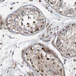 GRPEL2 Antibody in Immunohistochemistry (Paraffin) (IHC (P))
