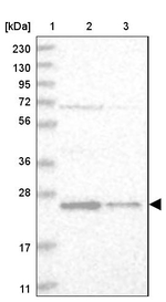 VBP1 Antibody in Western Blot (WB)